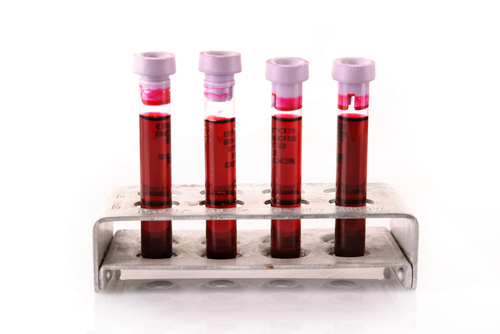 blood_tests_4